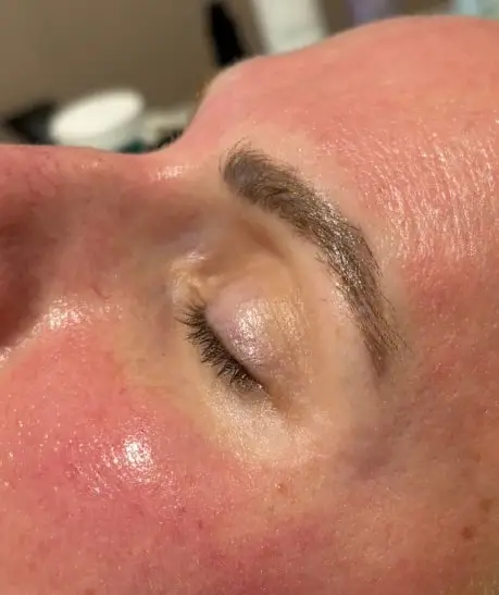 Microneedling — Ogden Lash and Wax, Ogden UT