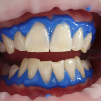 Ogden Lash And Wax Teeth Whitening — Ogden Lash and Wax, Ogden UT